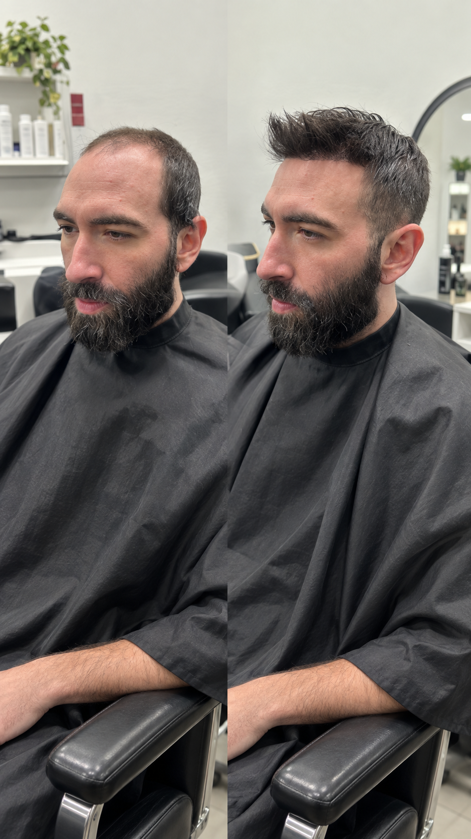 Mens Hair Loss Solutions Slidell Louisiana in Slidell and New Orleans Men's Hair Loss Solutions in Slidell, Louisiana