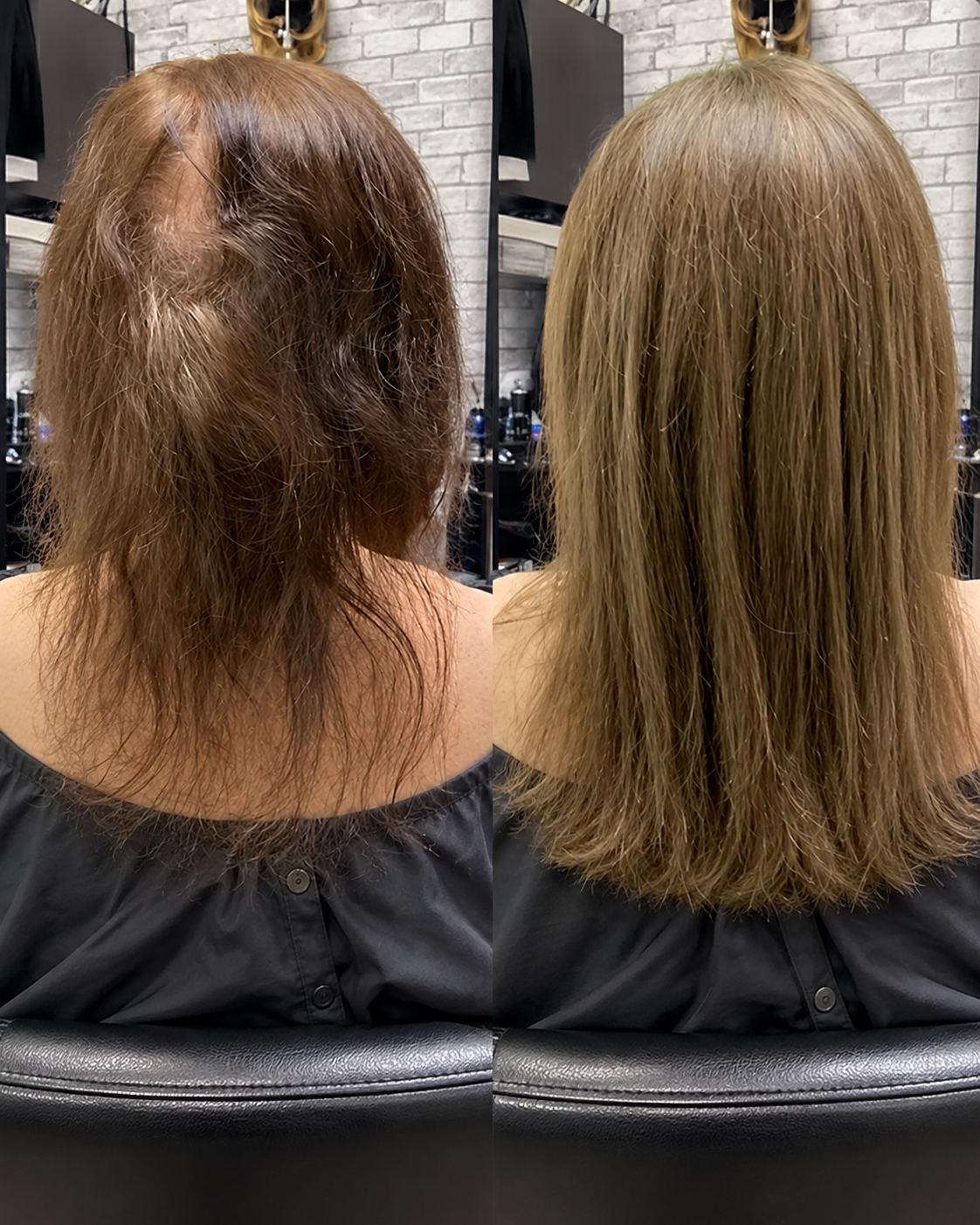 Womens Hair Loss Solutions Slidell Louisiana in Slidell and New Orleans Women's Hair Loss Solutions in Slidell, Louisiana