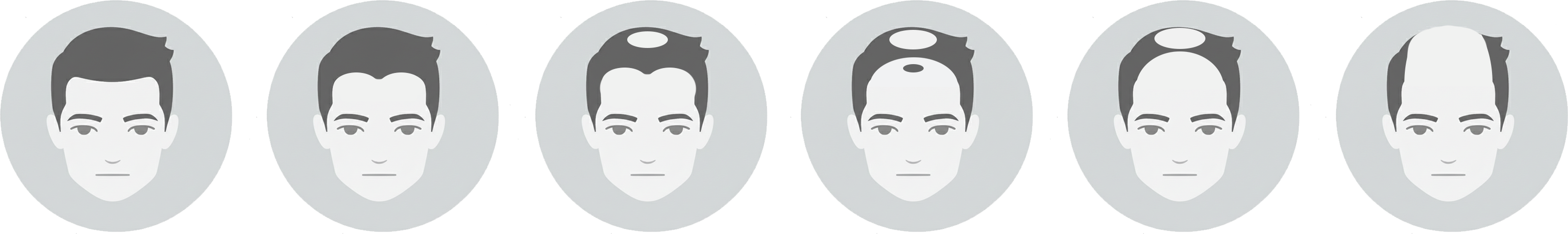 Men’s hair loss solutions in Slidell and New Orleans Men’s hair loss solutions in Slidell and New Orleans