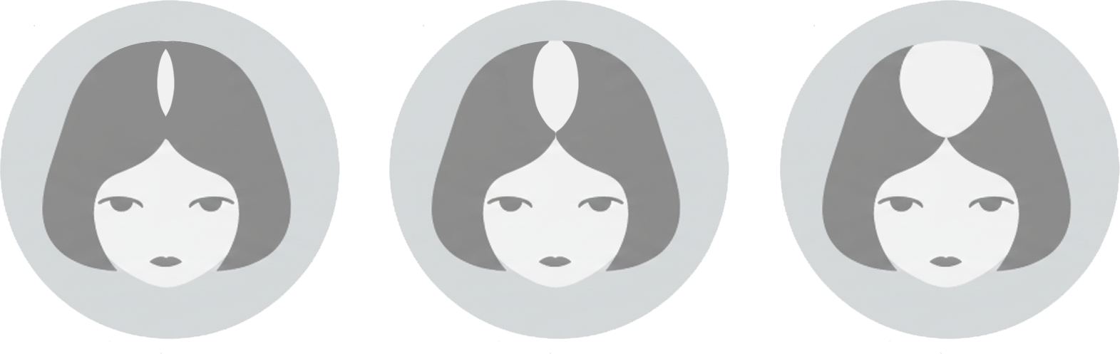 Women’s hair loss solutions in Slidell and New Orleans Women’s hair loss solutions in Slidell and New Orleans