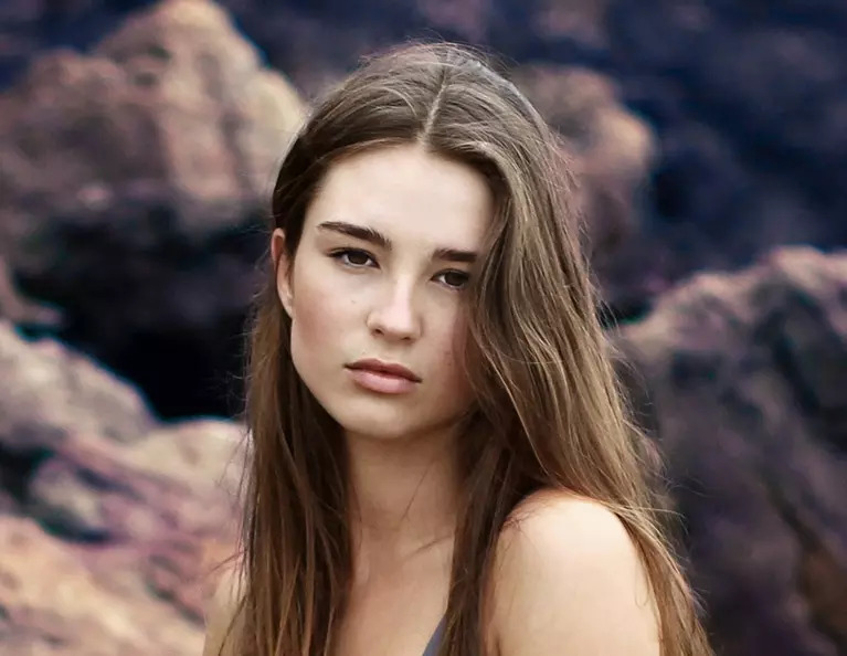 Women’s surgical hair loss treatment in Slidell and New Orleans